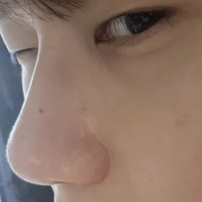 我覺得手術做得很好，謝謝。