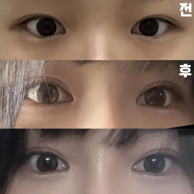 結果非常滿意，非常幸福。感謝院長!!