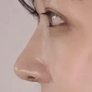 感謝您為我打造美麗的眼睛和鼻子