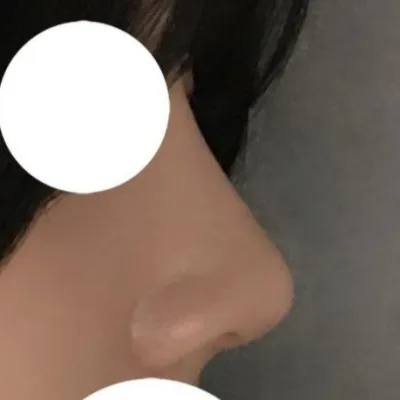 拍照的時候，鼻子線條非常滿意！