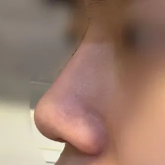 沒有強迫當天支付預約金，諮詢非常好！