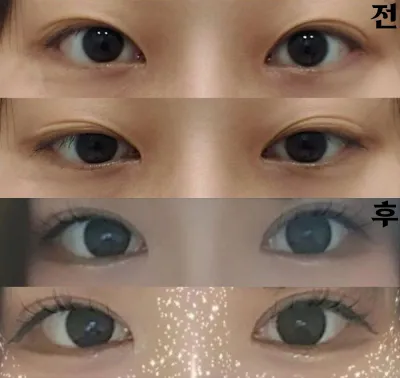 院長也很親切，所以我直接決定在這裡做了！！