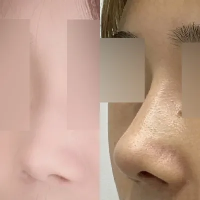 手術後變得自信了