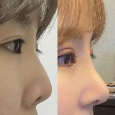 做了鼻部重修手術找了徐院長，做了眼部重修手術找了沈院長