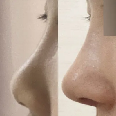 給沈正煥院長做手術已經兩週了