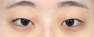 Before