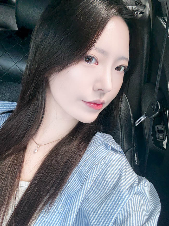 원트 코성형 후기! :)