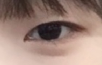 超級喜歡這次手術^^