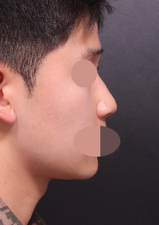 자신 있게 베리굿 성형외과 추천할 수 있을 것 같습니다.