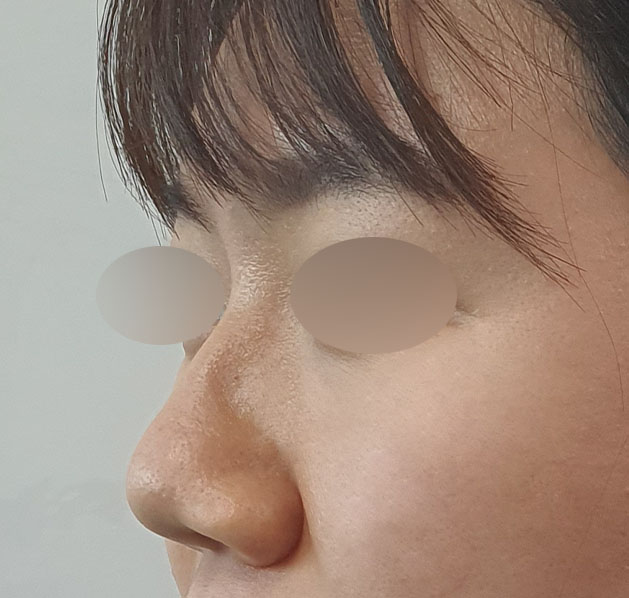 제 두번째 아버지인 김용우 원장님, 남재성 원장님!!! 예쁘게 수술 해주셔서 감사합니다!​♥♥