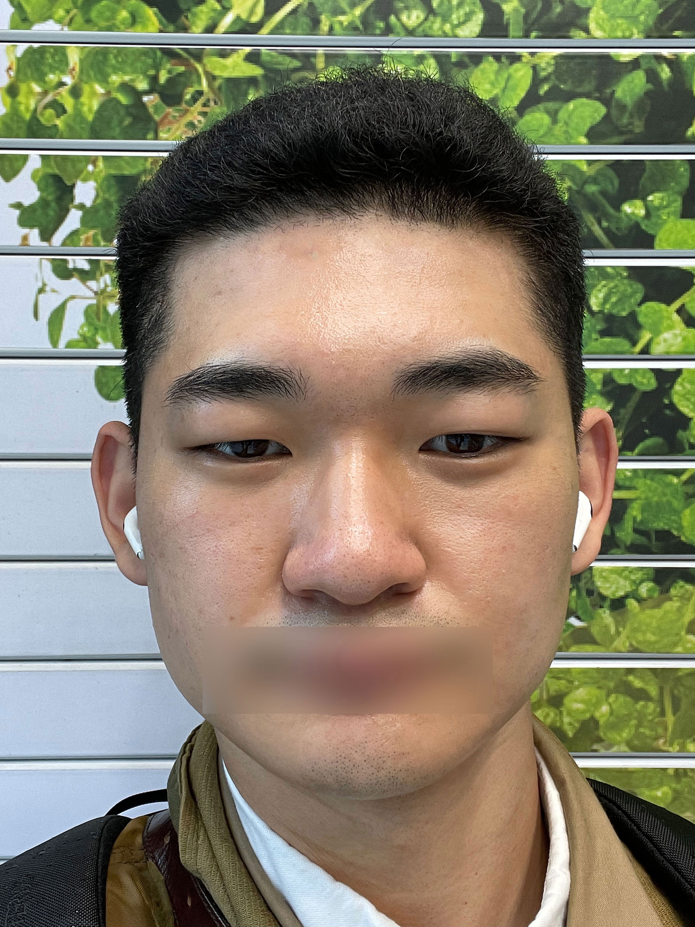 지금까지 살면서 인생에서 선택을 잘했다고 느끼는게 성형입니다