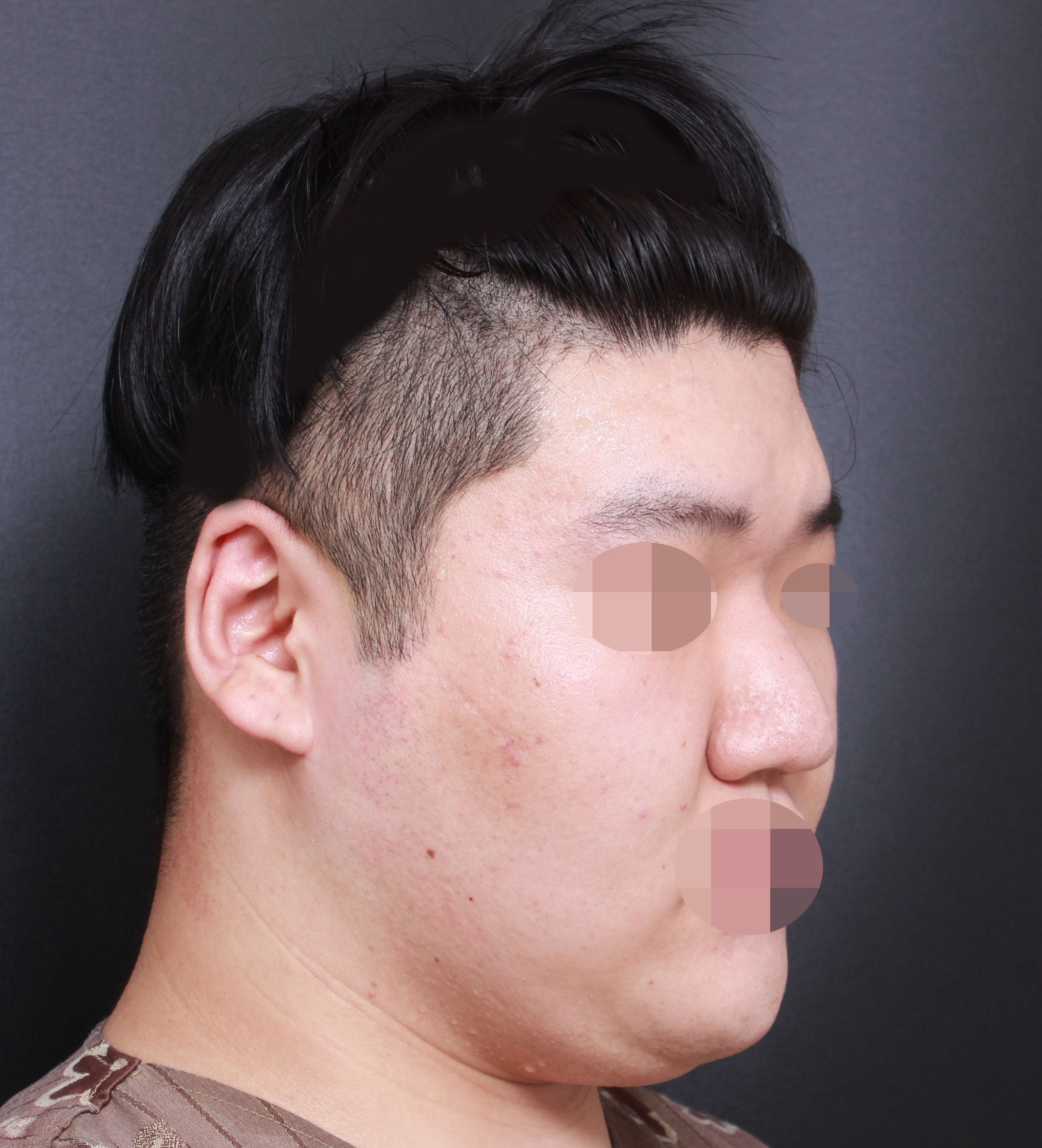 역시 임영민 대표원장님 최고