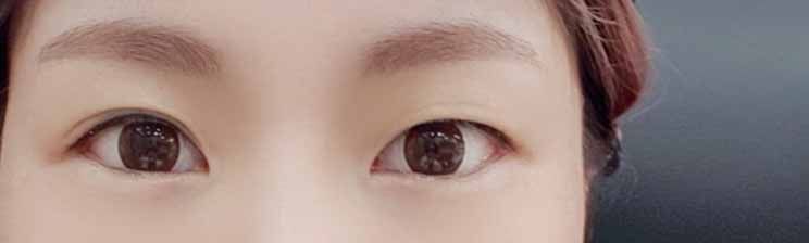 3개월차 후기남깁니다