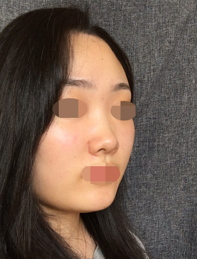 원장님이 정말 객관적으로 보안해야 할 점을 알려주시고 디자인적인 질문을 드렸더니 불가능한 부분도 미리 말씀해 주시고 솔직하게 상담해주셔서 더 좋았어요.