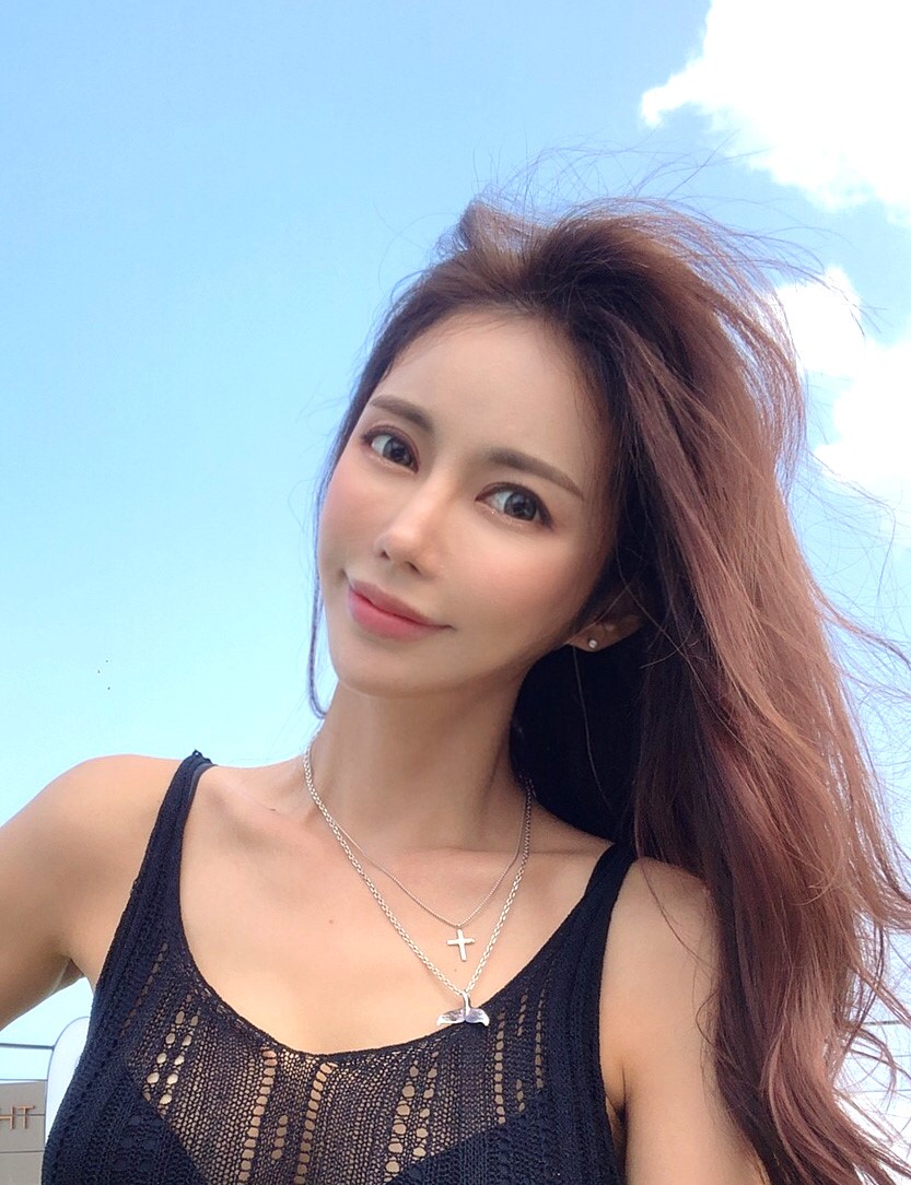 迷你拉皮、脂肪移植、抽脂（臉頰）