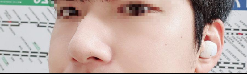 手術後5個月來寫後記了！