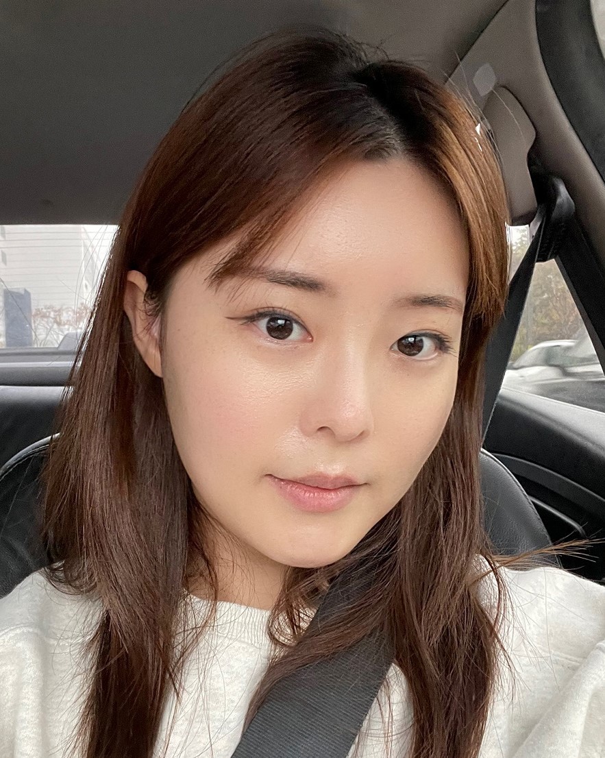 [眼睛] Chococho - 埋線雙眼皮（重修手術）