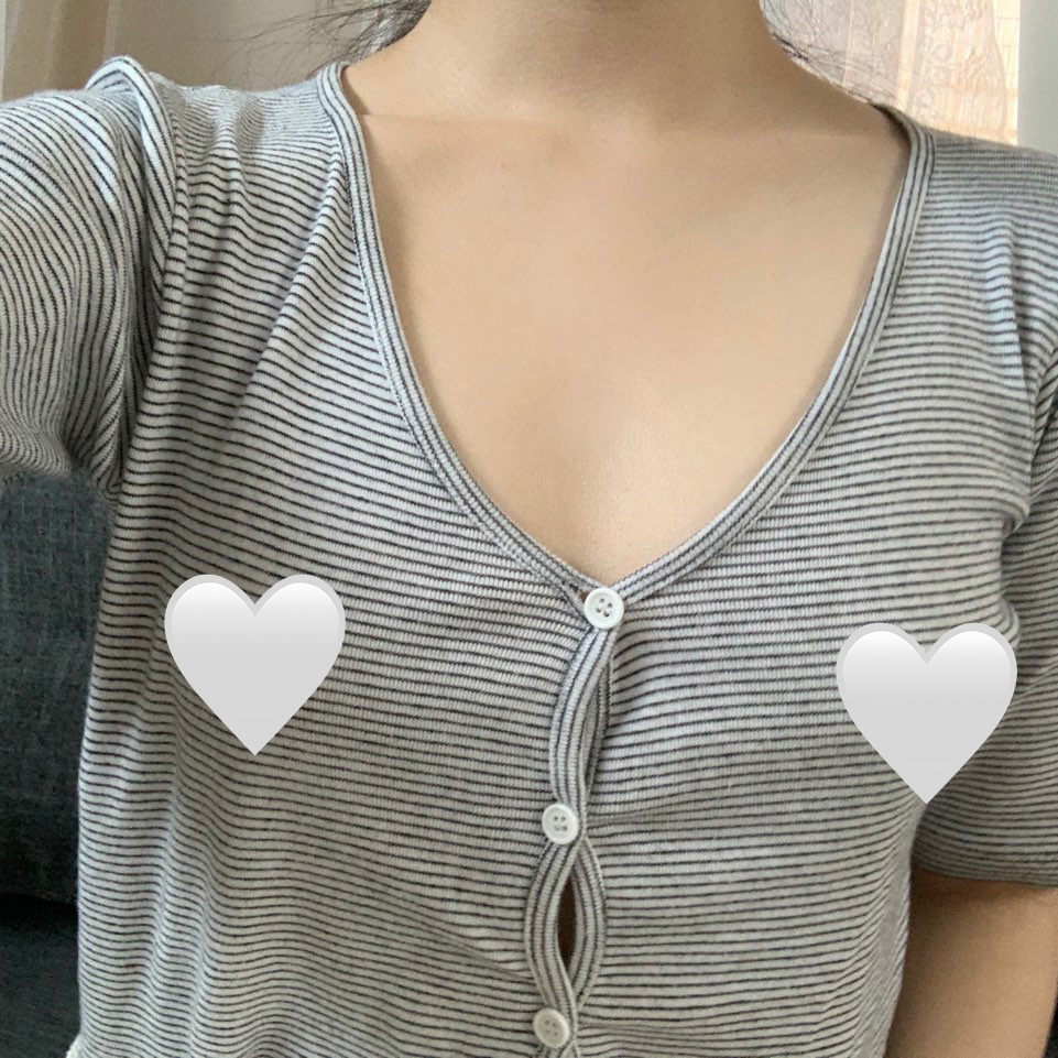 [隆胸] 春春春 - 隆胸