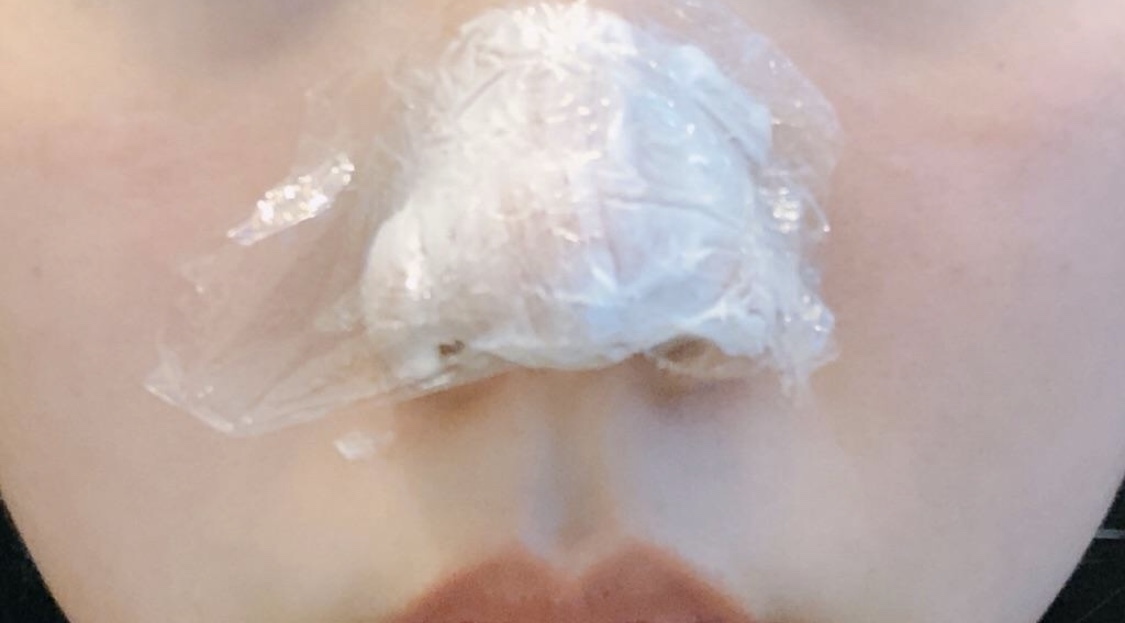 [微整形] Frurie - 肉毒桿菌, 鼻尖