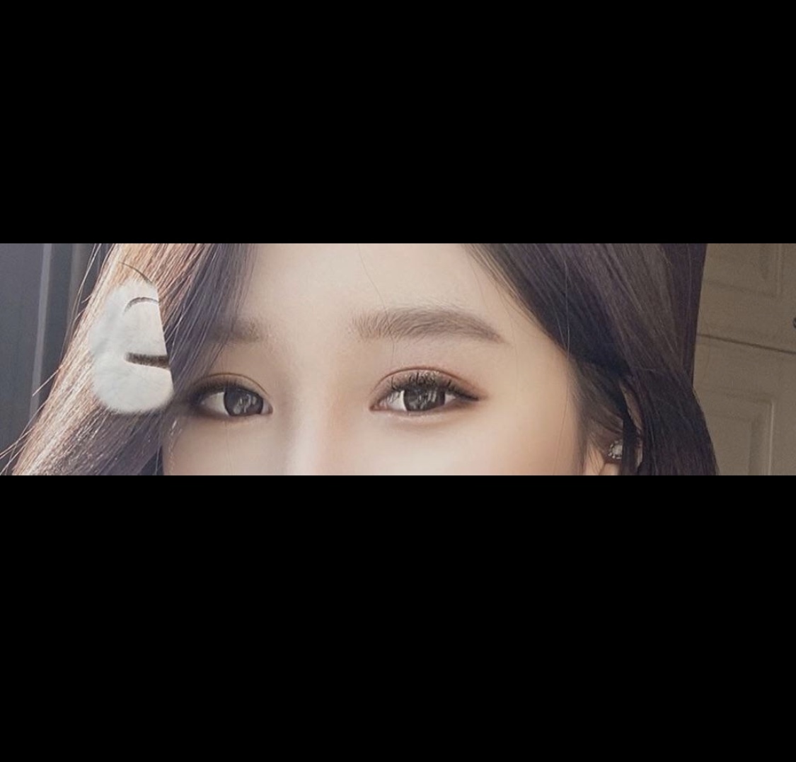 [眼部] 예니옌1017 - 雙眼皮