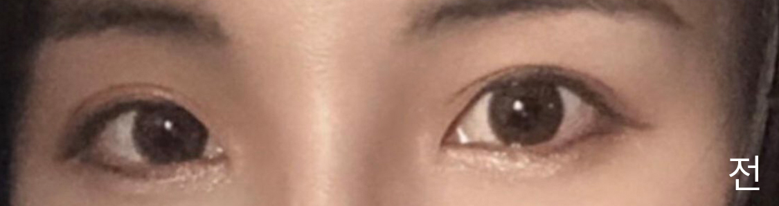 [眼睛] Trinity91 - 眼睛