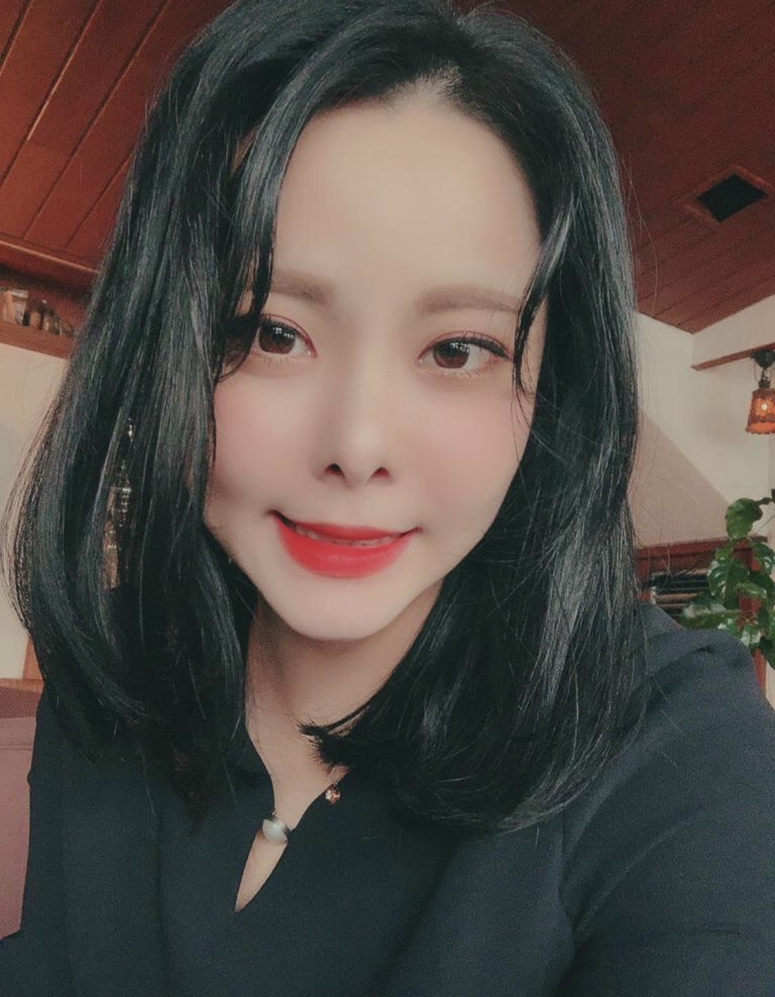 [眼部] songi1938 - 後眼角切開、下眼瞼下至