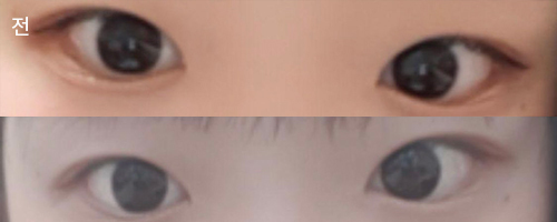 [眼睛] 我是申恩瑞 - 眼睛