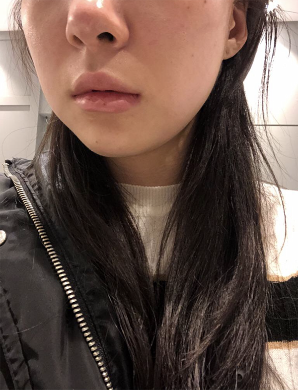 [皮膚] Hanhaneung - 音波拉提