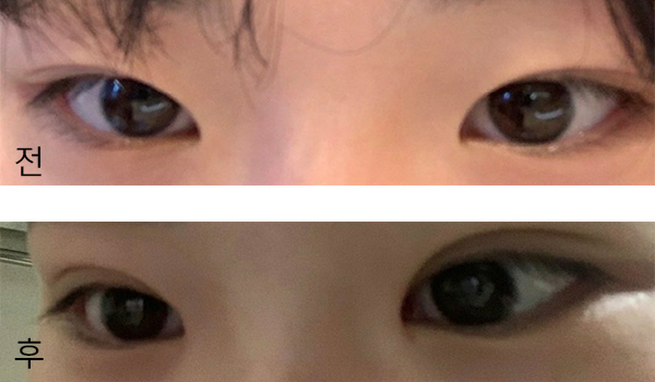 [眼睛] 쵸키1234 - 眼睛