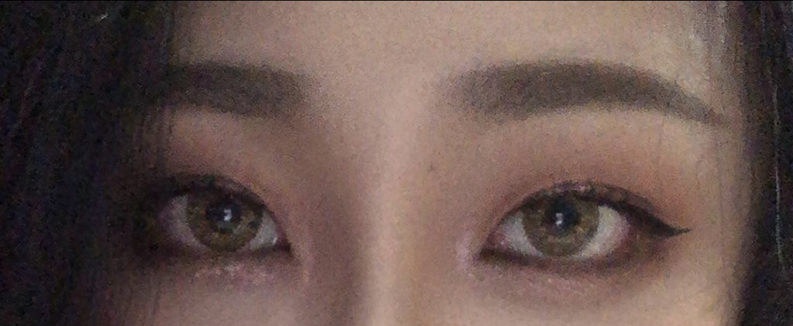 [眼睛] High High Neung - 下眼瞼下至, 後眼角切開