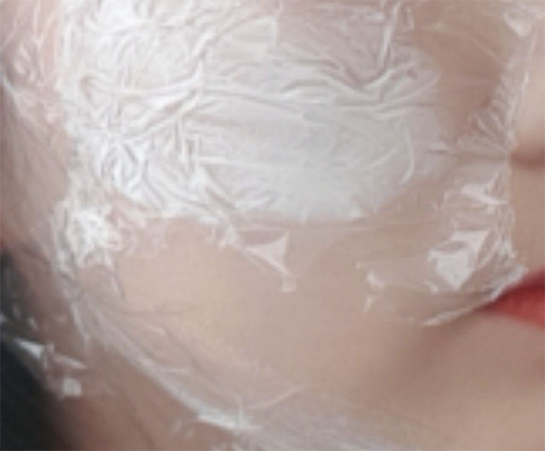 [皮膚] 黃土토리 - Ultherapy超聲刀, 香奈兒注射