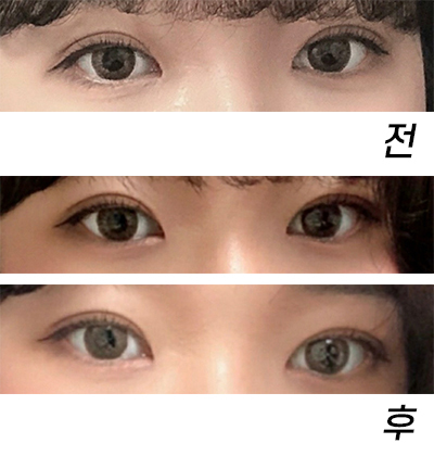 [眼睛] qhrehd - 眼睛