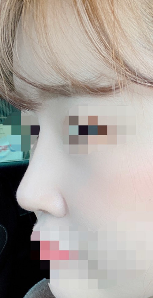 [鼻部] Shav - 鼻部