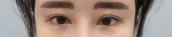 [眼睛] kkime - 眼睛