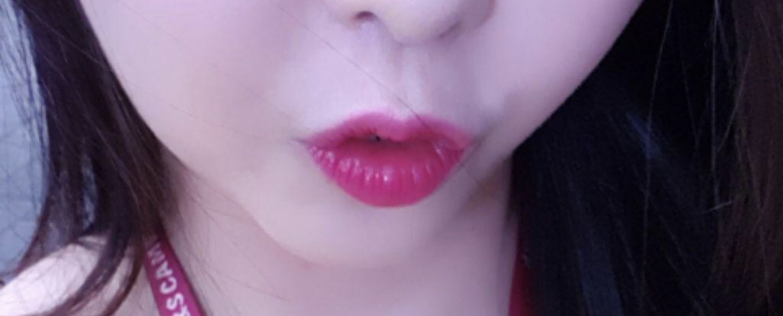 [微整] 黃金比例蕾雅 - 填充劑、埋線拉提