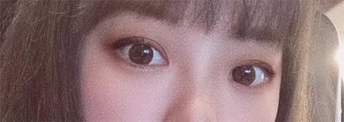 [眼睛] 李曙峼醫師 - 眼睛