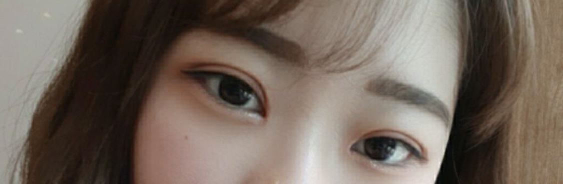 [眼睛] msdmsquf2 - 雙眼皮埋線、開眼頭