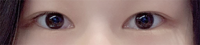 [眼睛] yyyi - 眼睛