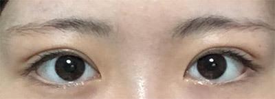 [眼睛] 權東夏 - 眼睛