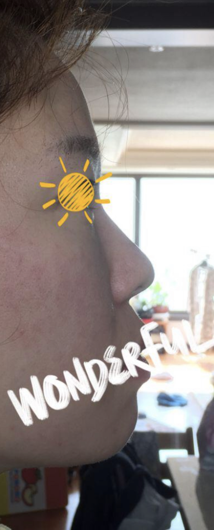 [鼻] Shee288 - 鼻樑、鼻尖