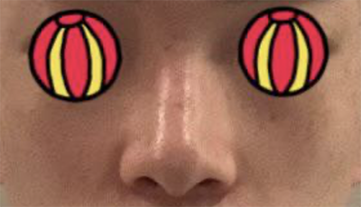 [鼻] 혀니9801 - 鼻