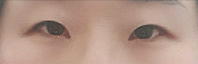 [眼睛] 핑구찐 - 眼睛