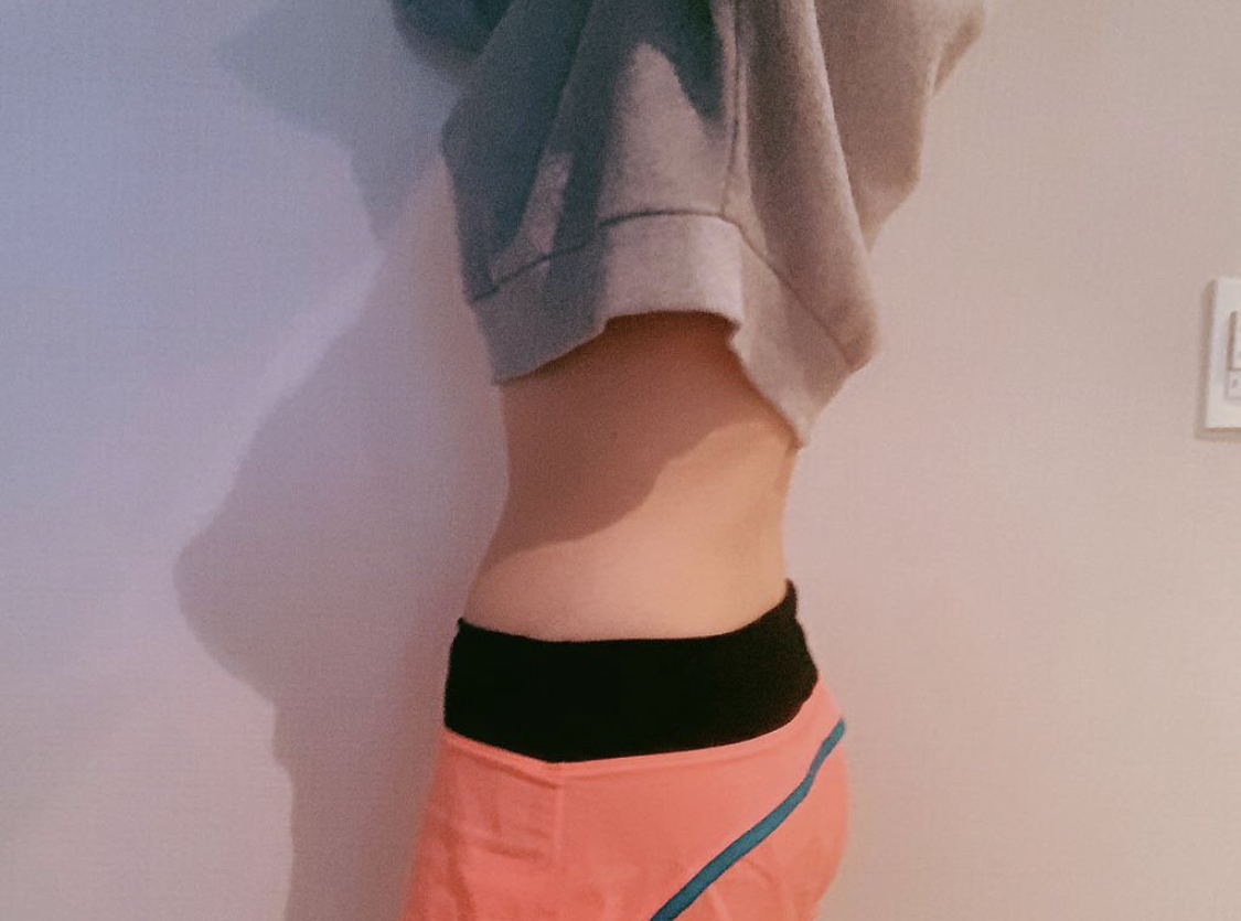 [抽脂] yedu87 - 腿部、腹部抽脂