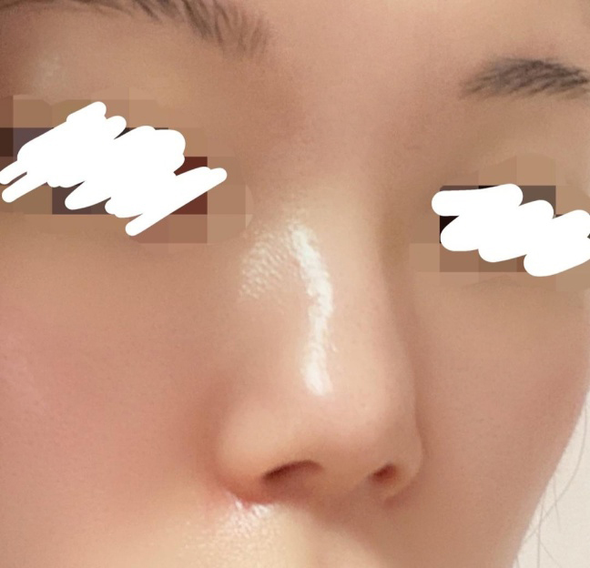 [鼻] 욤이쓰 - 鼻