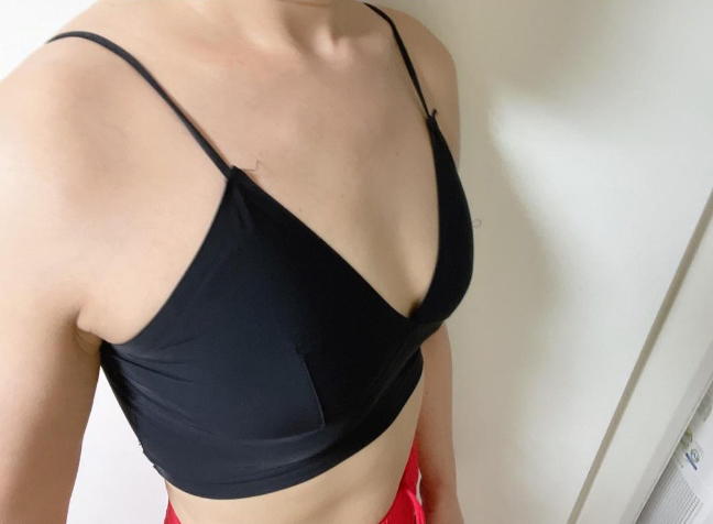 [隆胸] Barbie33 - 隆胸（假體）