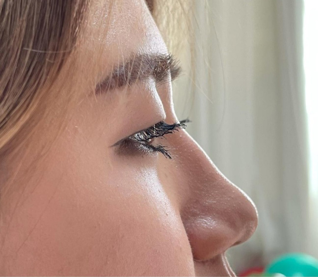 [鼻] 咕잉咕잉咕잉 - 鼻子