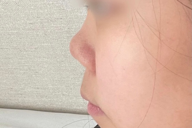 [鼻] 全智賢2 - 鼻樑