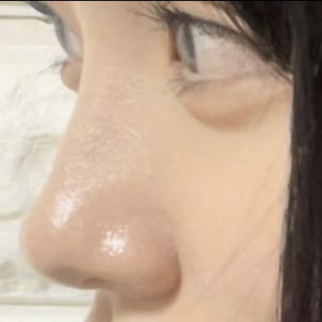 [鼻] 又又伊1 - 鼻