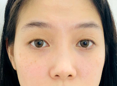 [眼部] 벧걸 - 眼、鼻