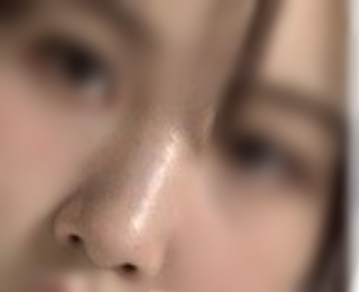 [鼻] 鼻部整形 - 我的鼻子